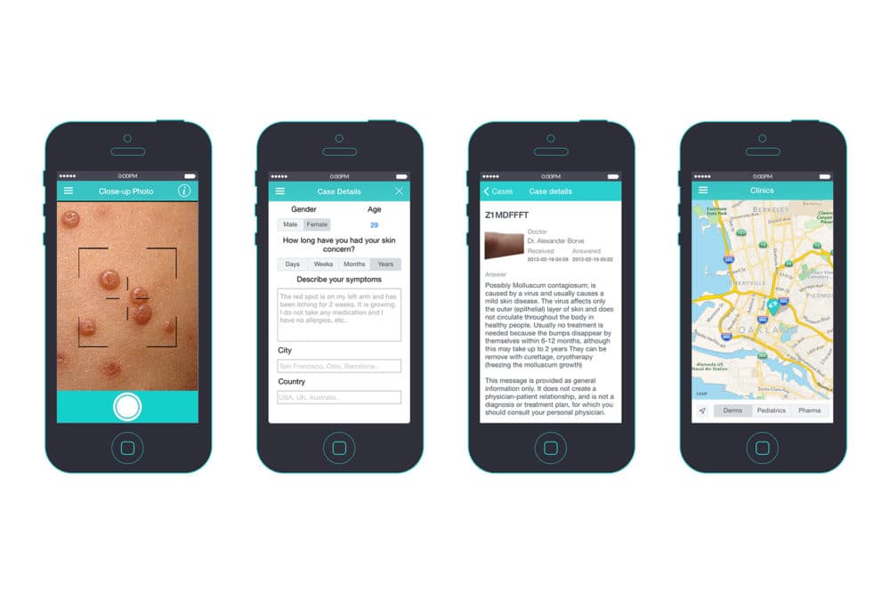 Suspicious Skin Moles? Rashes? There's Now An App For That Here & Now