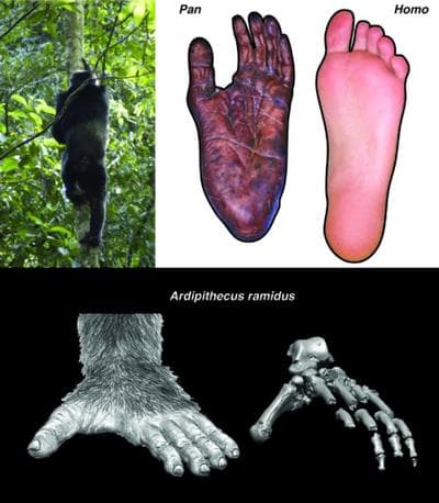 Ardifoot
