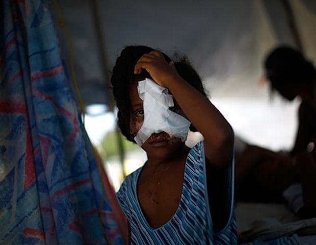 A Haitian girl, whose nose and cheek were shattered in the quake, holds her head at the main hospital in downtown Port-au-Prince on Jan. 16.  (David Gilkey/NPR)