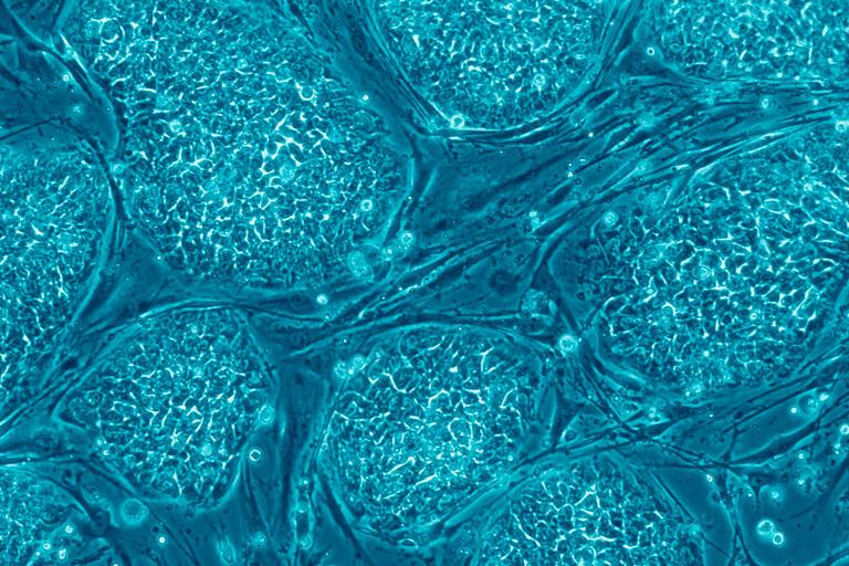 Human embryonic stem cells. (Public Library of Science)