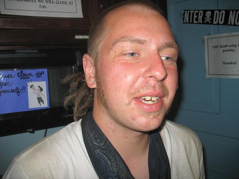 Gabe, who has used heroin, says “everyone has Hep C.” (Martha Bebinger/WBUR)