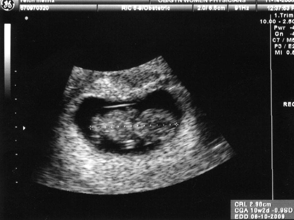 In the past, most parents could determine the sex of their child at about 20 months. (mobeans/Flickr)