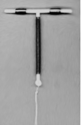 The copper ParaGard IUD