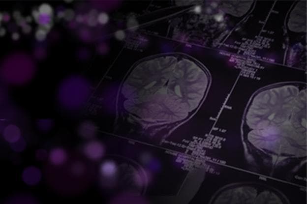 The Mental And Physical Toll Of Alzheimer's Care
