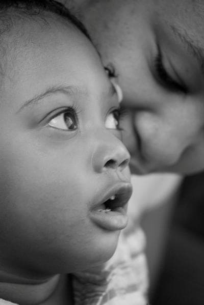 A Chicago child now living withTay-Sachs. It is now known that the "Jewish disease" actually crosses ethnic groups.