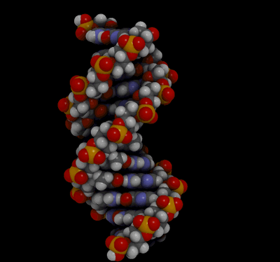 днк синдром дауна. синдром дауна набор хромосом. основные симптомы синдрома дауна. хромосомный набор с болезнью дауна. болезнь дауна этиология.