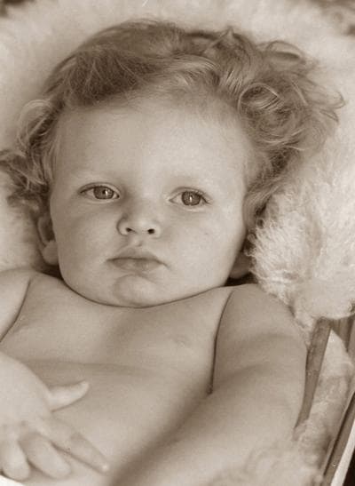 A child who died of Tay-Sachs Disease