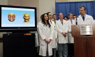 Plastic surgeon Dr. Bohdan Pomahac, far right, in a news conference at Brigham and Women's Hospital in Boston on March 21, to discuss his team's completion of the first full face transplant in the U.S. (AP)