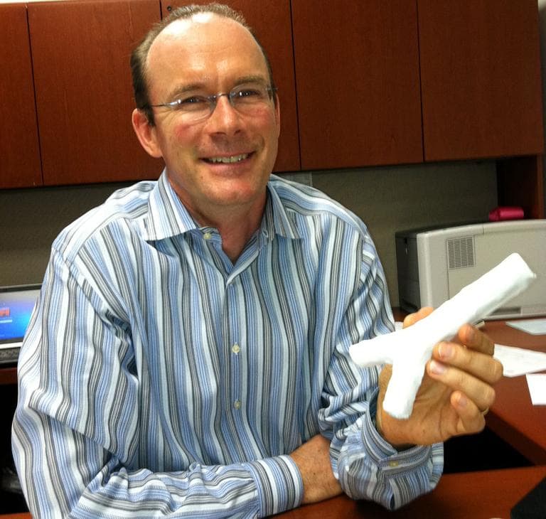 David Green, president of Harvard Bioscience, holds a synthetic trachea. (Deborah Becker/WBUR)