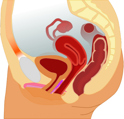 Consumer Advocates: FDA's Action On Vaginal Mesh 'Too Little Too Late'