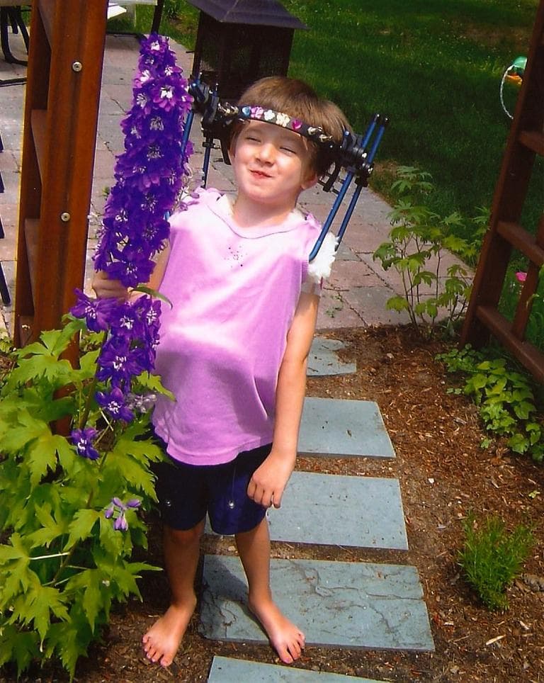 Riley wearing her post-surgery halo