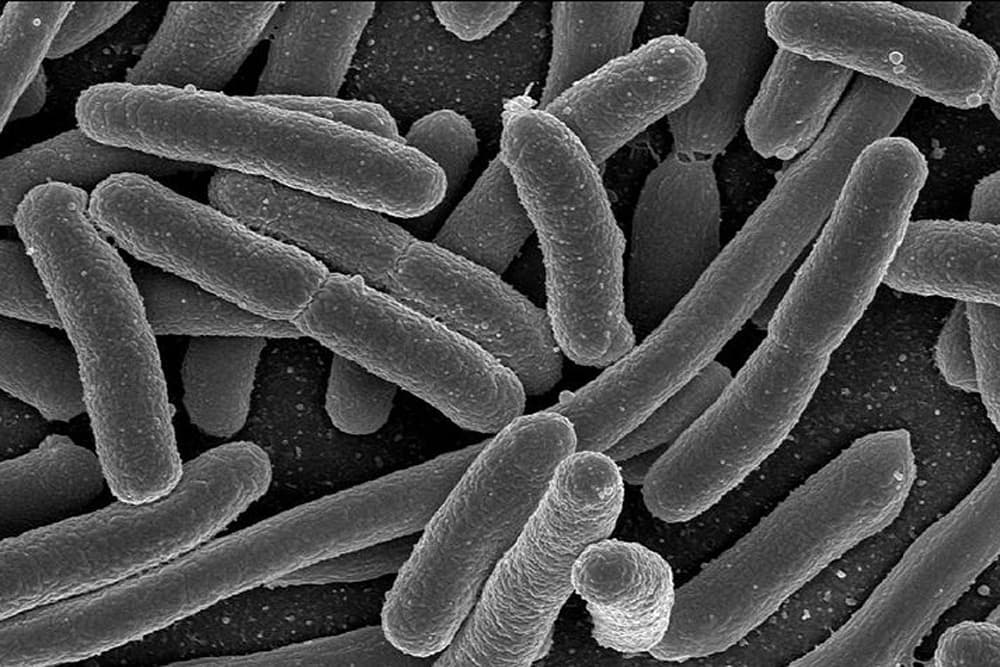 Bacteria under a microscope.