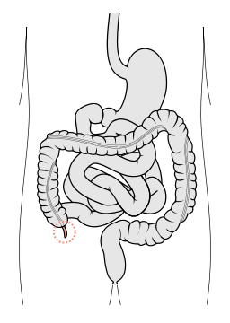 The appendix marked in red (Olek Remesz, Wikimedia)