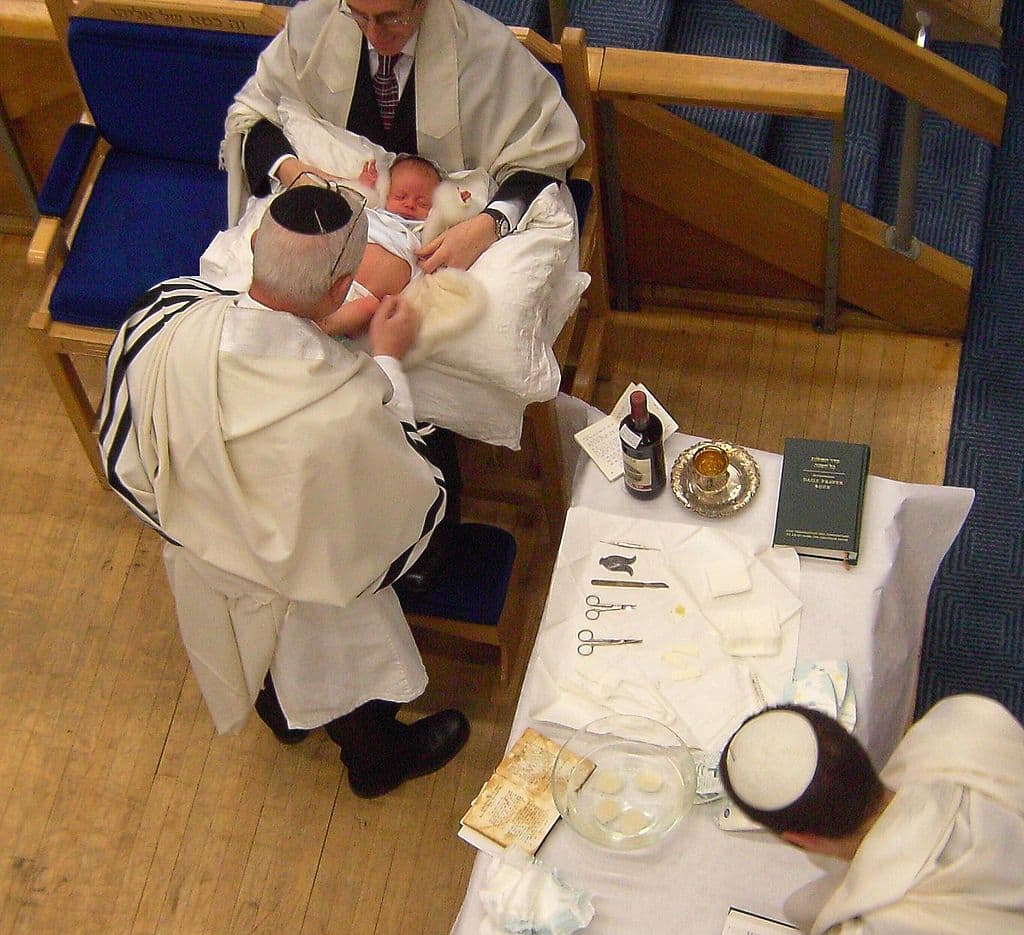 Preparing for a circumcision