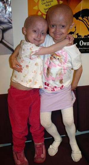 (Courtesy of the Progeria Research Foundation)