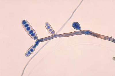 Exserohilum rostratum