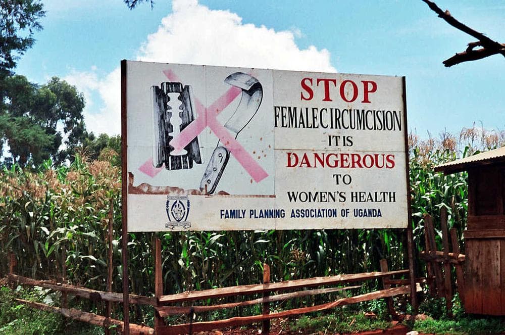 female circumcision