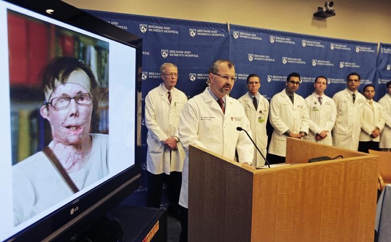 Dr. Bodhan Pomahac, at podium, with his surgical team, speaks to reporters regarding the face transplant of Carmen Blandin Tarleton, pictured left, at Brigham and Women's Hospital in Boston on Wednesday.(Charles Krupa/AP)