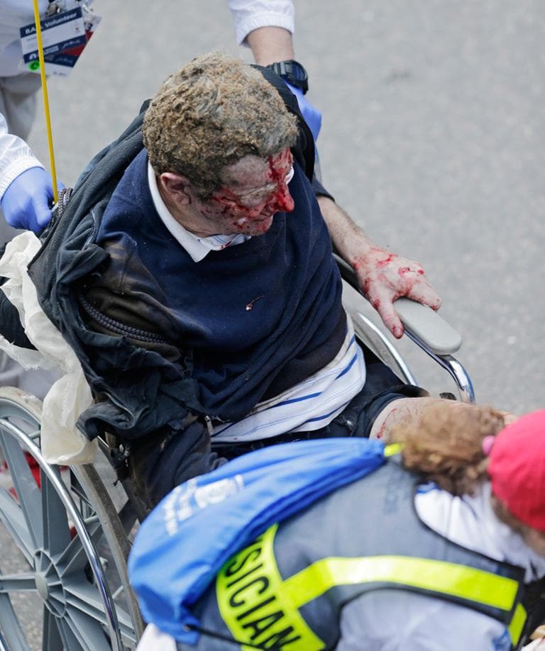 Medical workers aid an injured man at the finish line of the 2013 Boston Marathon following an explosion there Monday, April 15, 2013 in Boston. Two explosions shattered the euphoria at the finish line on Monday, sending authorities out on the course to carry off the injured while the stragglers were rerouted away from the smoking site of the blasts. (Charles Krupa/AP)