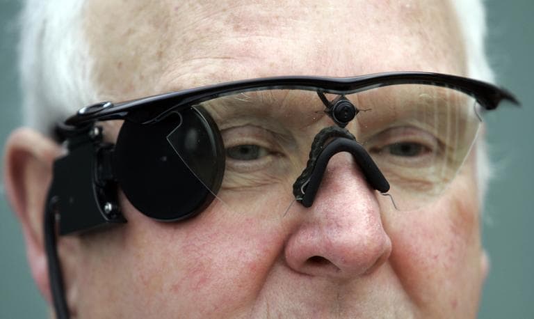 Eric Selby poses for a photograph in Coventry, England, in February 2011. He's wearing a "sight" camera fitted in a pair of glasses, which works in conjunction with an artificial retina implant called the Argus II fitted in his right eye, enabling him to detect light. (Martin Cleaver/AP)