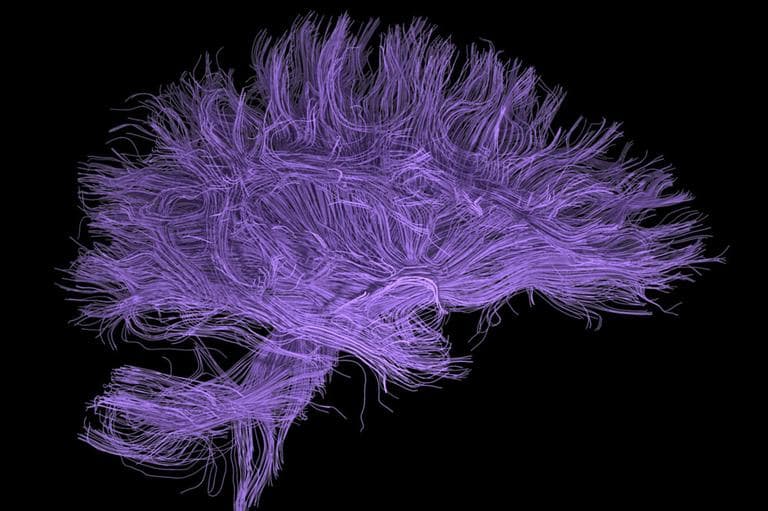 Brain Art showcases prizewinners in the 2012 Brain-Art Competition that honors outstanding visualizations of brain research data. The works are by John Van Horn (US), Neda Jahanshad (US), Betty Lee (US), Daniel Margulies (US) and Alexander Schäfer (DE). (Flickr/Ars Electronica)