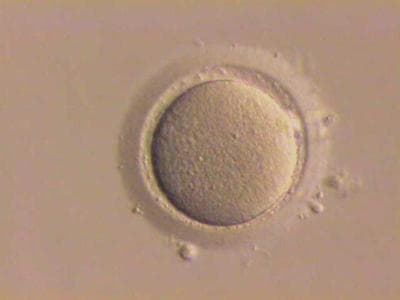 "Stripped" human oocyte. (Wikipedia)