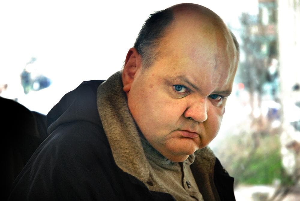 Kevin Fitzgerald, after surgery, his vision restored (George Hicks/WBUR)