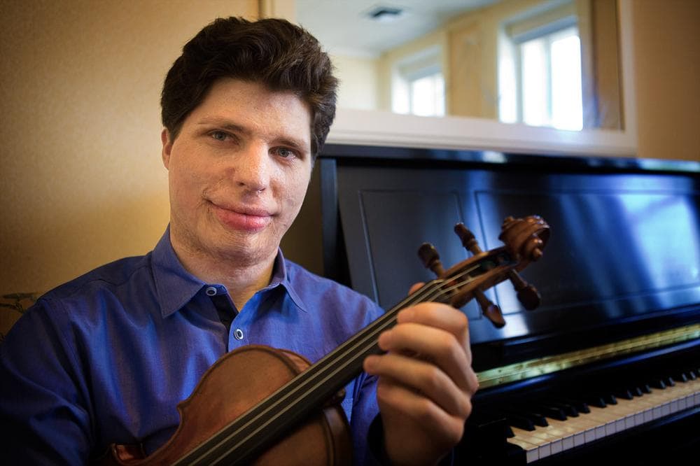 Augustin Hadelich (Jesse Costa/WBUR)