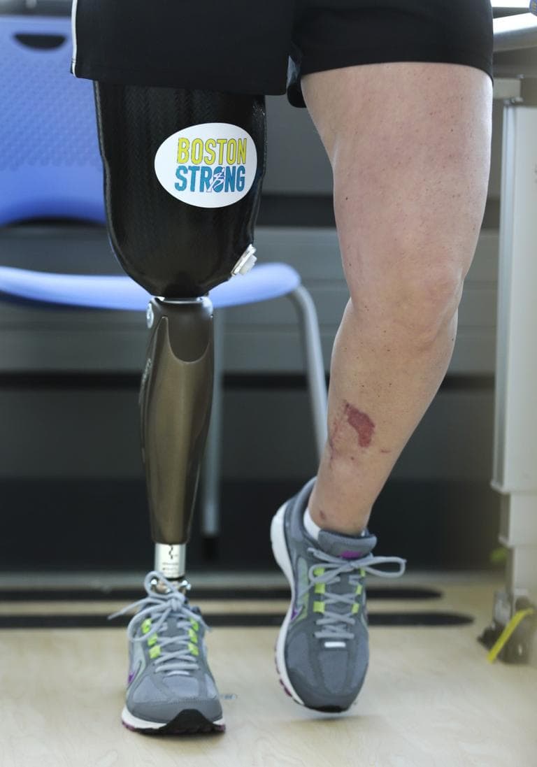With a "Boston Strong" sticker on the thigh covering of her prosthetic leg, Boston Marathon bombing survivor Roseann Sdoia walks between parallel bars at the Spaulding Rehabilitation Hospital in June. (Charles Krupa/AP)