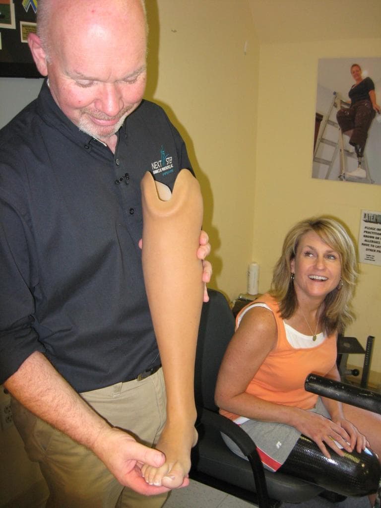 Sdoia’s dress leg. (Martha Bebinger/WBUR)