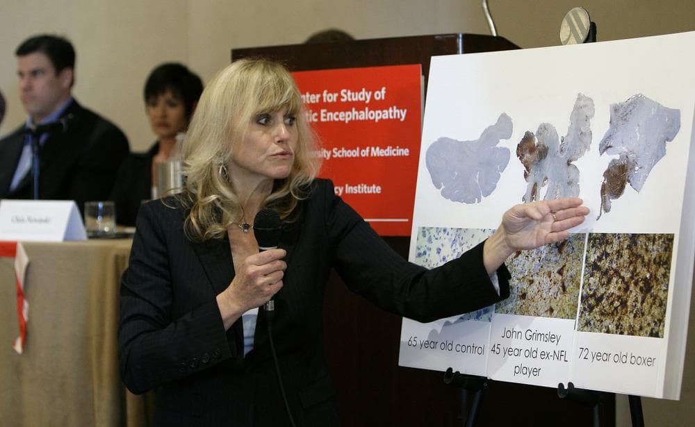 Dr. Ann McKee (Chris O'Meara/AP)