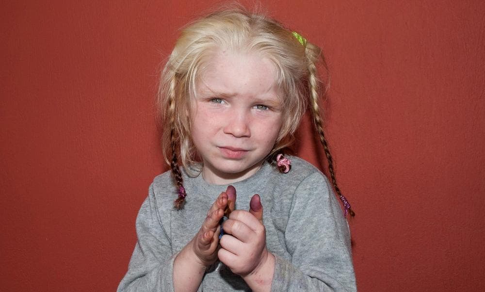Greek authorities have requested international assistance to identify this four-year-old girl found living in a Gypsy camp. (Greek Police via AP)
