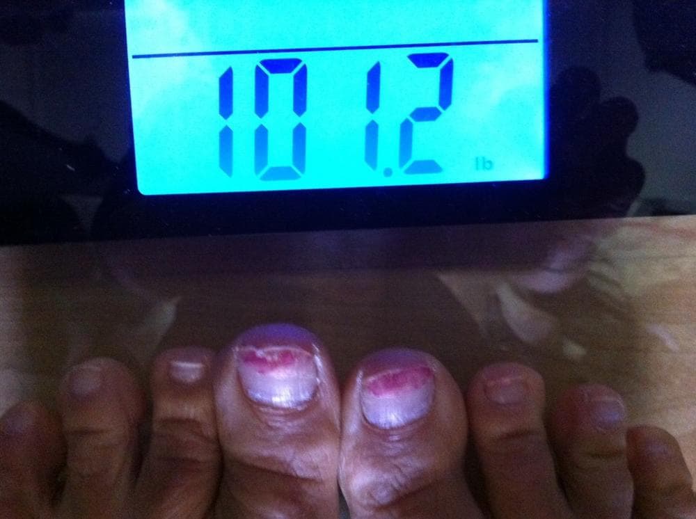 (Rachel Zimmerman/WBUR)