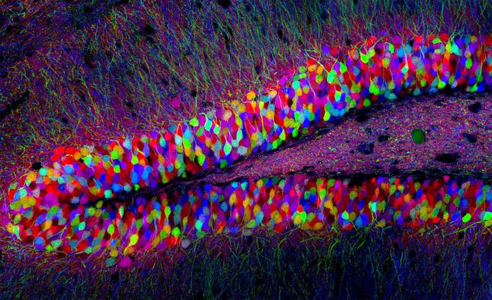 2014: CommonHealth Year Of The Brain, From Depression To Dyslexia