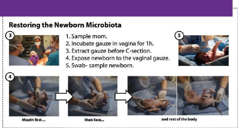 From a poster at the recent Boston meeting of the American Society of Microbiology. (Courtesy Dr. Dominguez-Bello)