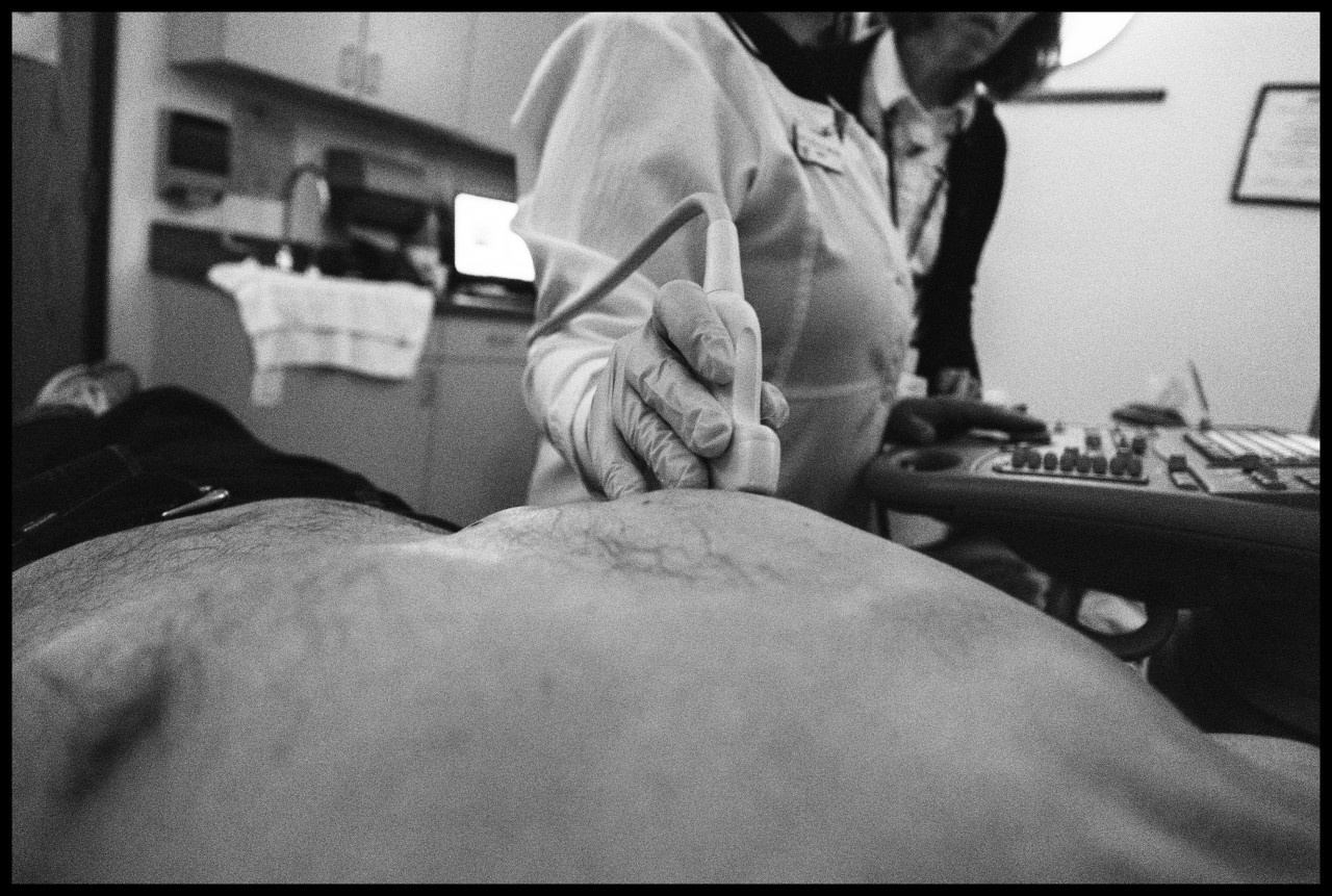 B.D. Colen also photographed his own ultrasound procedure ((c) B.D. Colen, 2014)