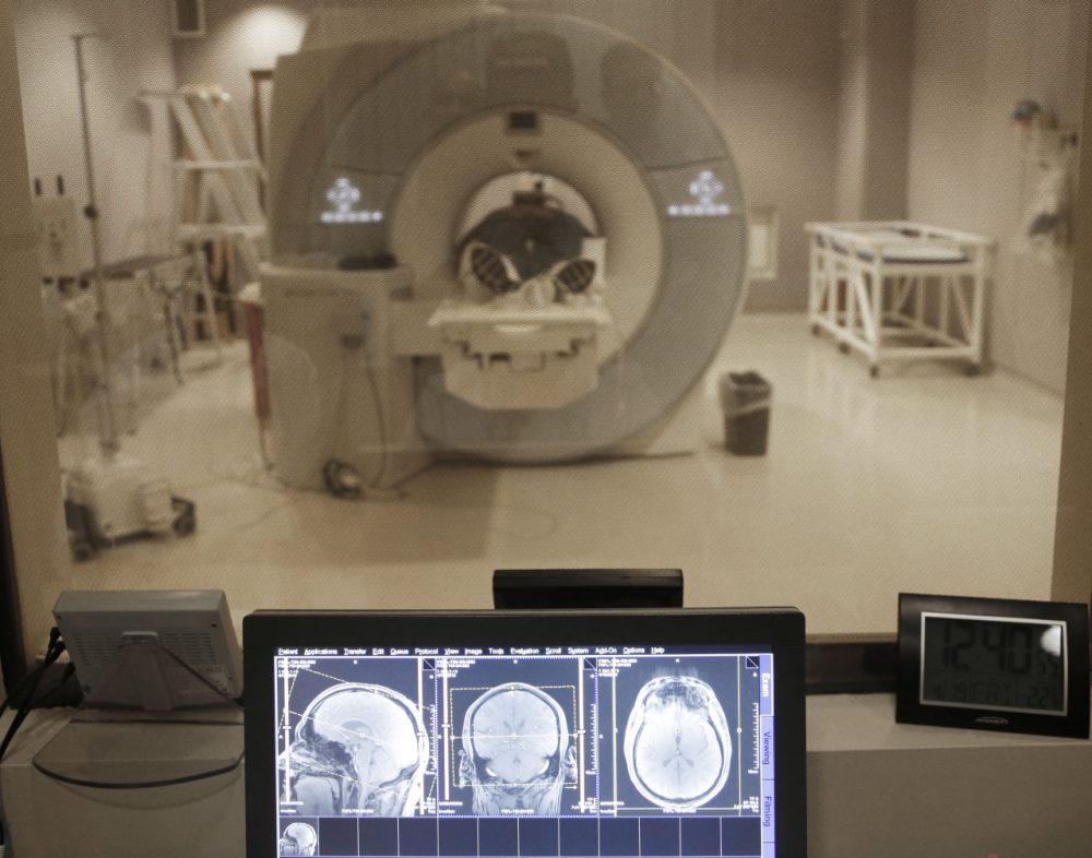 Dr. Annie Brewster reflects on her changing MRI scans, which are changing as a result of her multiple sclerosis diagnosis. A controversial tax on medical devices like an MRI machine will return in 2018 unless lawmakers change something. (Paul Sancya/AP/File)