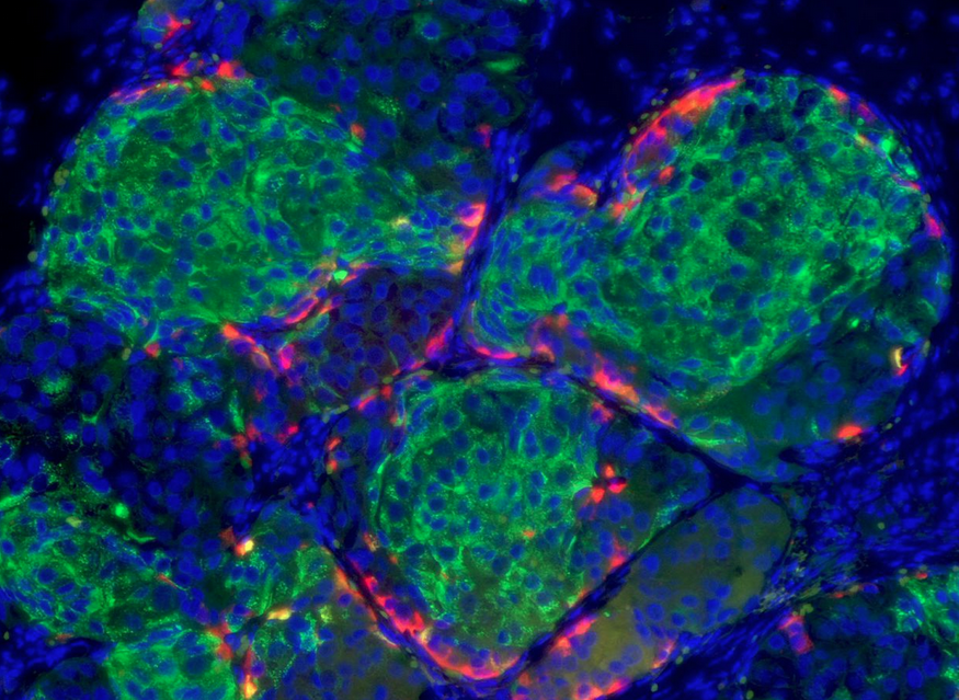 Human Stem Cell Beta Cells/Photo Courtesy Doug Melton, Harvard University