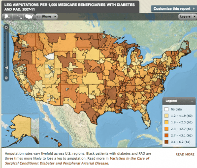 Report Shows Stark Care Disparities, More Amputations Among Black Diabetics