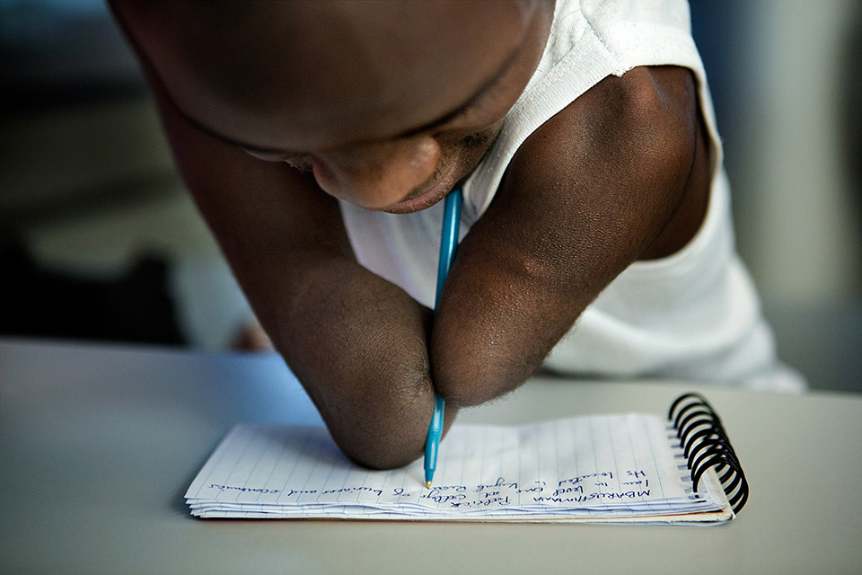 Patrick Mbarushimana, 22, of Rwanda demonstrates how he can write with no hands. He has new prosthetics from a Dorchester manufacturer. (Jesse Costa/WBUR)