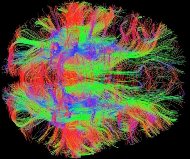 A map of nerve fibers in the human brain (. (Courtesy of Zeynep Saygin/Massachusetts Institute of Technology.)
