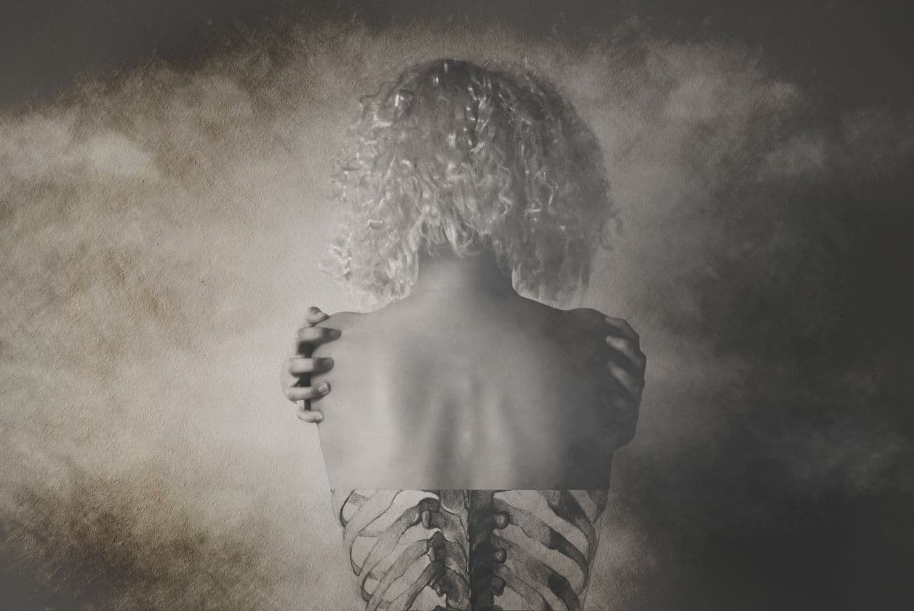 Anorexia: Potentially Deadly, Treatable And Still Not Always Covered By Insurance
