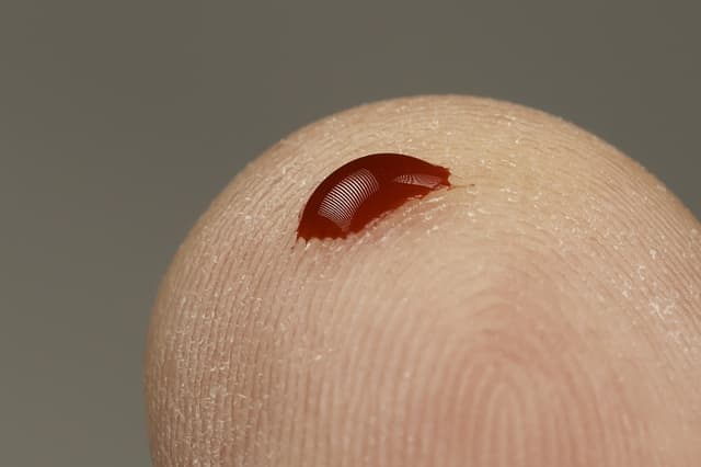 A blood test to check glucose levels (Alden Chadwick/Flickr Creative Commons)