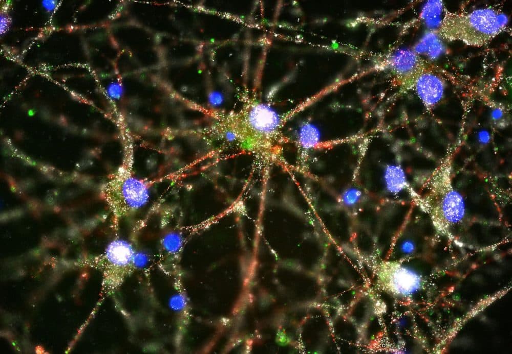 Image made with a fluorescent microscope shows C4 proteins, green, located at the synapses in a culture of human neurons. In research released Wednesday, scientists pursuing the biological roots of schizophrenia have zeroed in on a potential factor. (Heather de Rivera/McCarroll Lab/Harvard/AP)