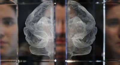 If The Brain Is Dead, Are You?