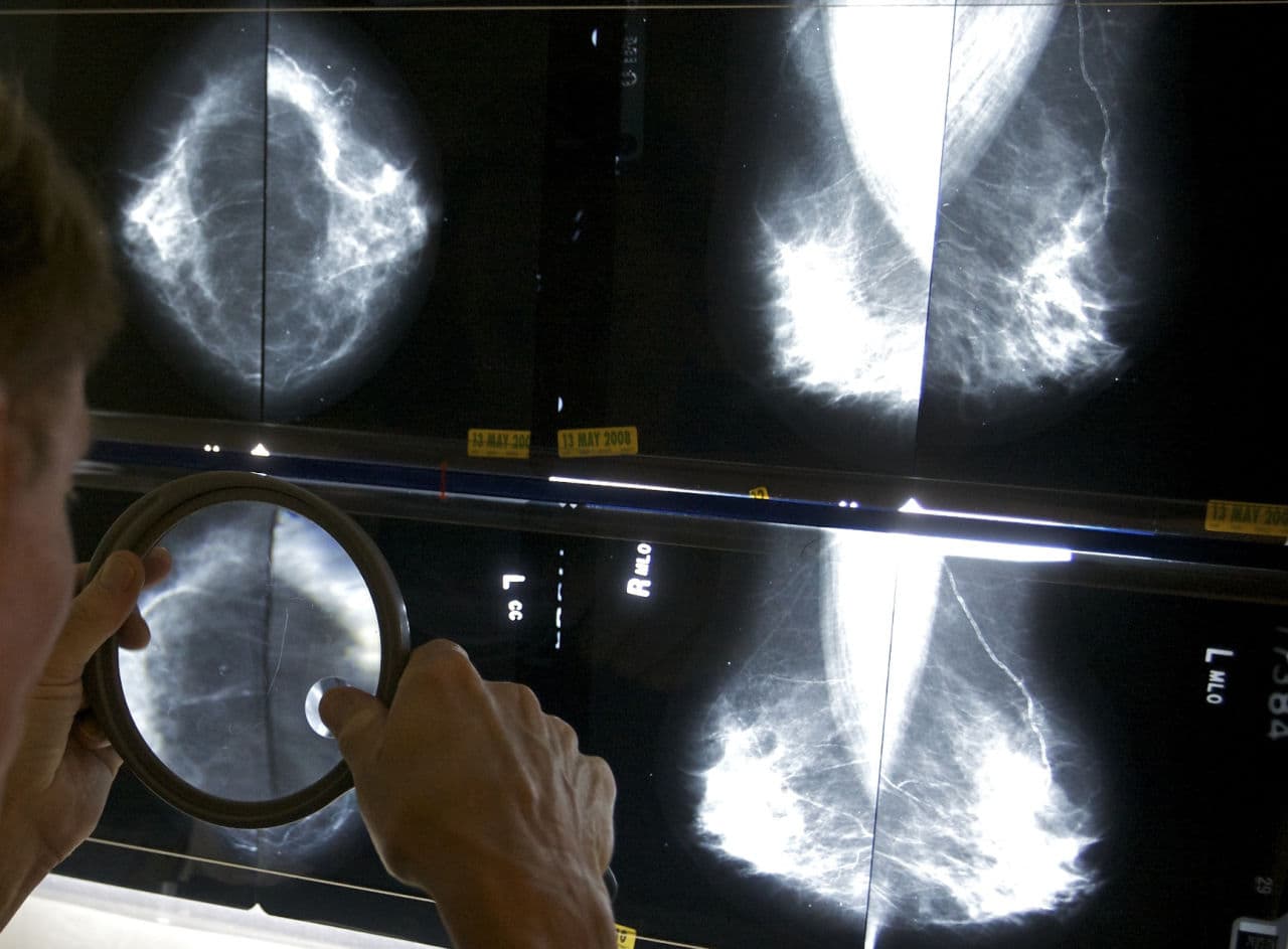 Colonoscopies, Mammograms And Childbirth Are Americans' Most-Shopped Health Services