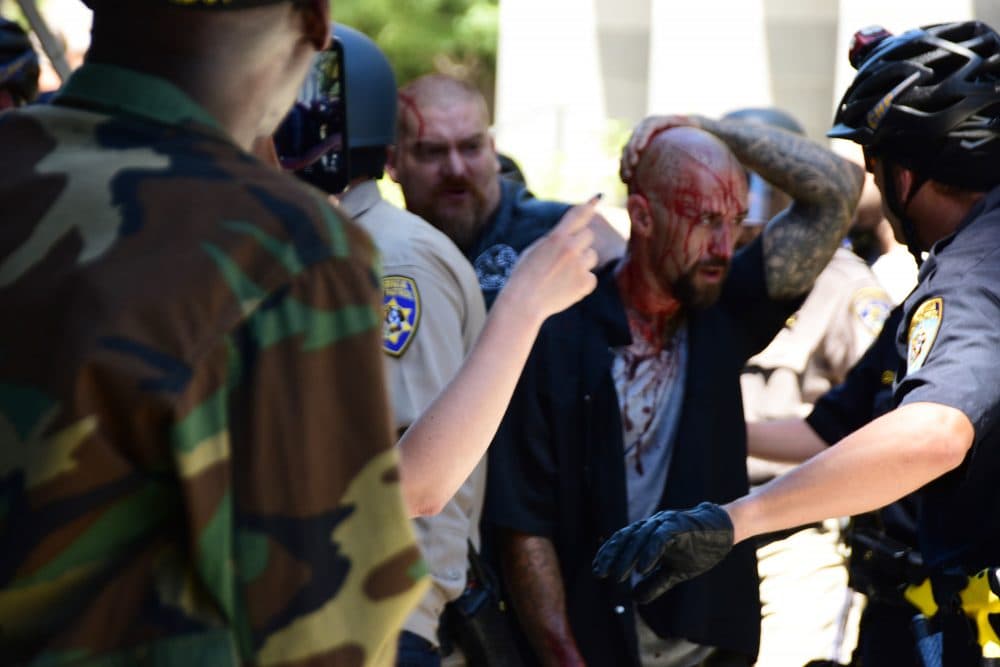 Police escort wounded man away from in front of the Capitol in Scramento, Sunday, June 26, 2016, after members of right-wing extremists groups holding a rally outside the California state Capitol building clashed with counter-protesters, authorities said. Sacramento Police spokesman Matt McPhail said the Traditionalist Workers Party had scheduled and received a permit to protest at noon Sunday in front of the Capitol. McPhail said a group showed up to demonstrate against them. (Steven Styles/AP)