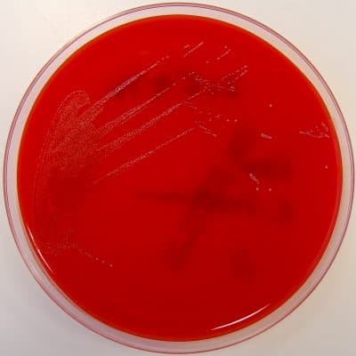 Enterococcus faecium on Columbia Horse Blood Agar (Nathan Reading/Flickr)