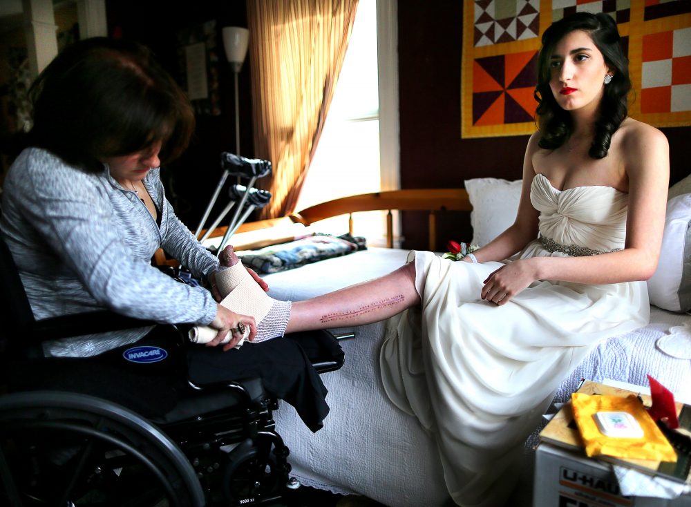 Sydney Corcoran, a victim of the Marathon bombing, gets ready for her Lowell High School senior prom in May of 2013. Her mother Celeste, who lost both her legs in the bombing, changes the bandages on her injured foot. (Courtesy John Tlumacki/Boston Globe/HBO)
