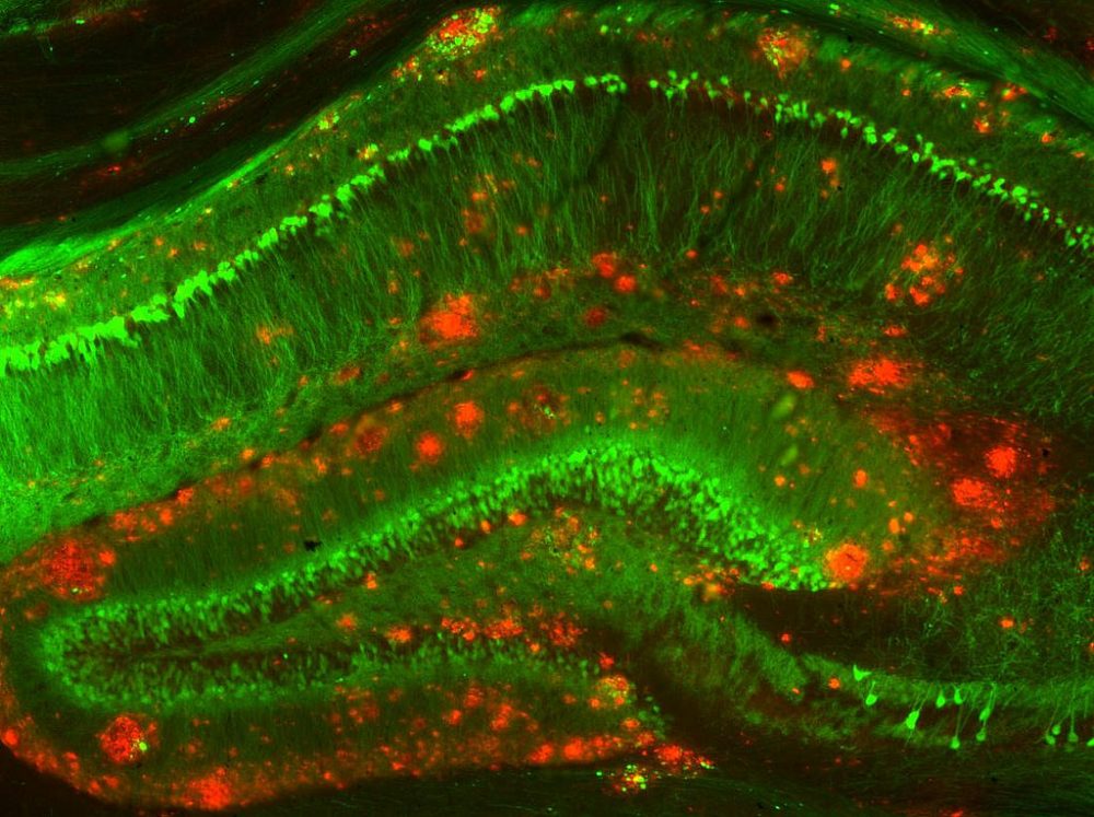 In a mouse model of Alzheimer’s disease, amyloid beta clusters (red) build up among neurons (green) in a memory-related area of the brain. (NIH Image Gallery/Flickr)